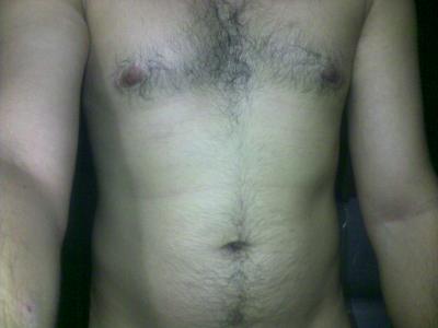 My milky white body