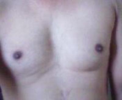Myboobs2
