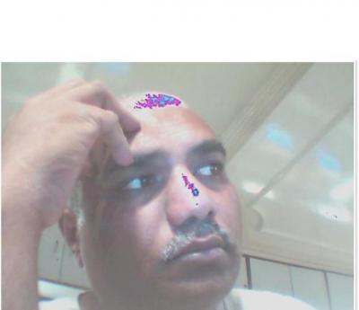 Moi